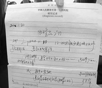 医生忘记患者是处女 B超仪器破处女膜(图)